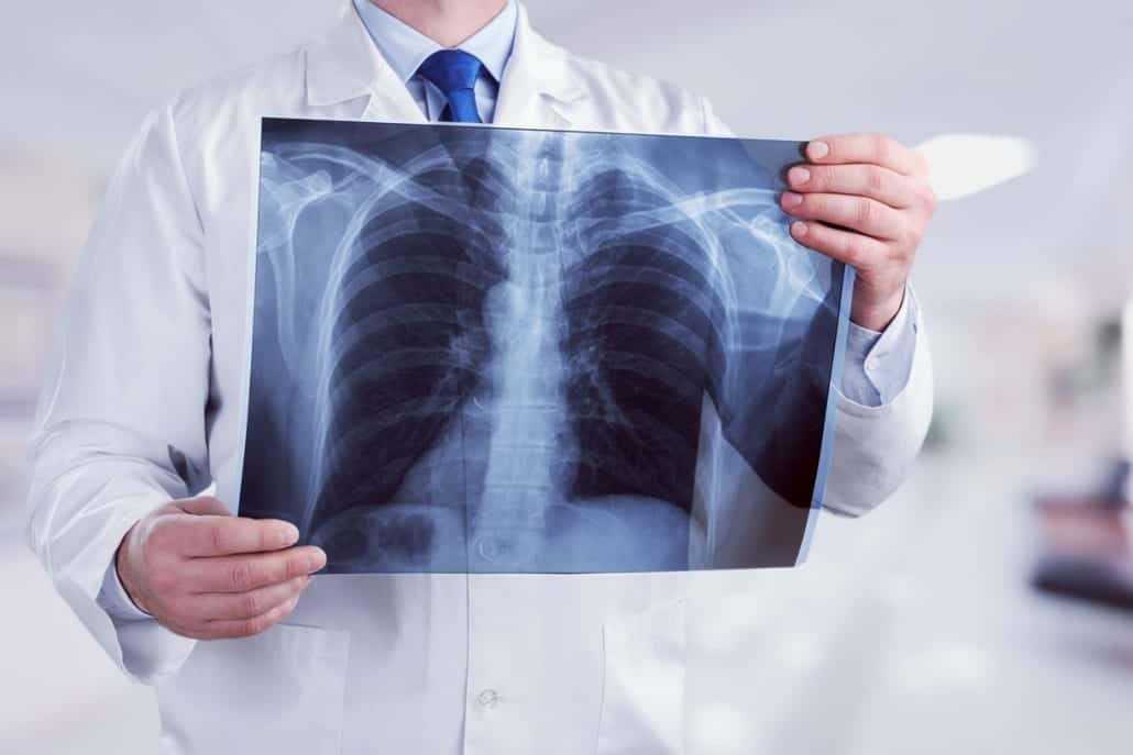 X-ray