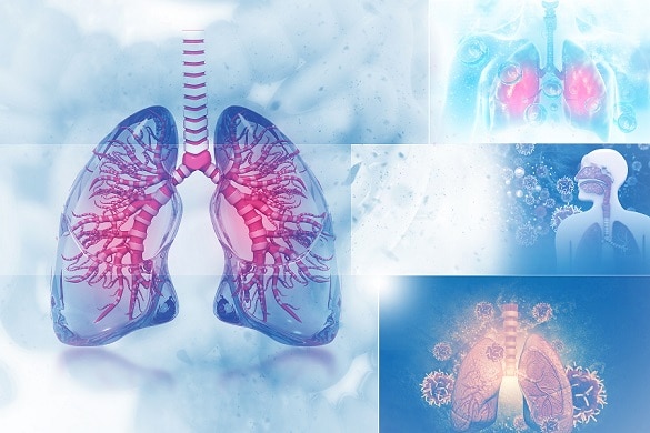 Pulmonary